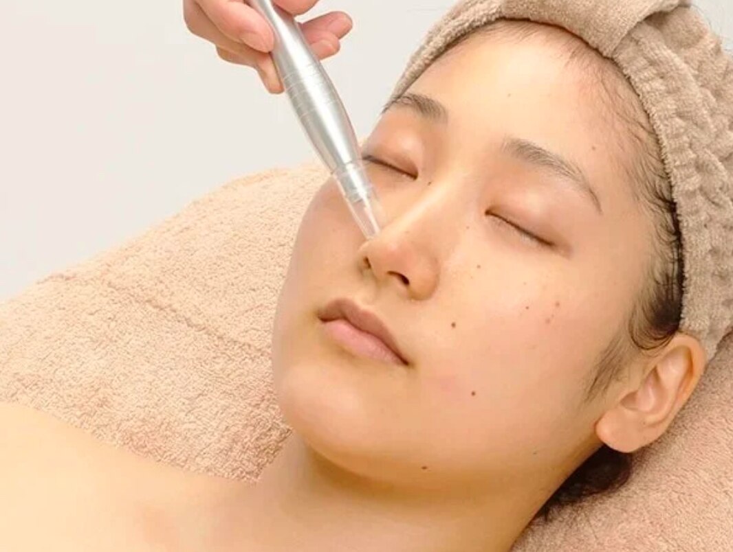 【ボディ人気NO.1】背上or背下　剥離ハーブピーリング 通常 ¥22,000