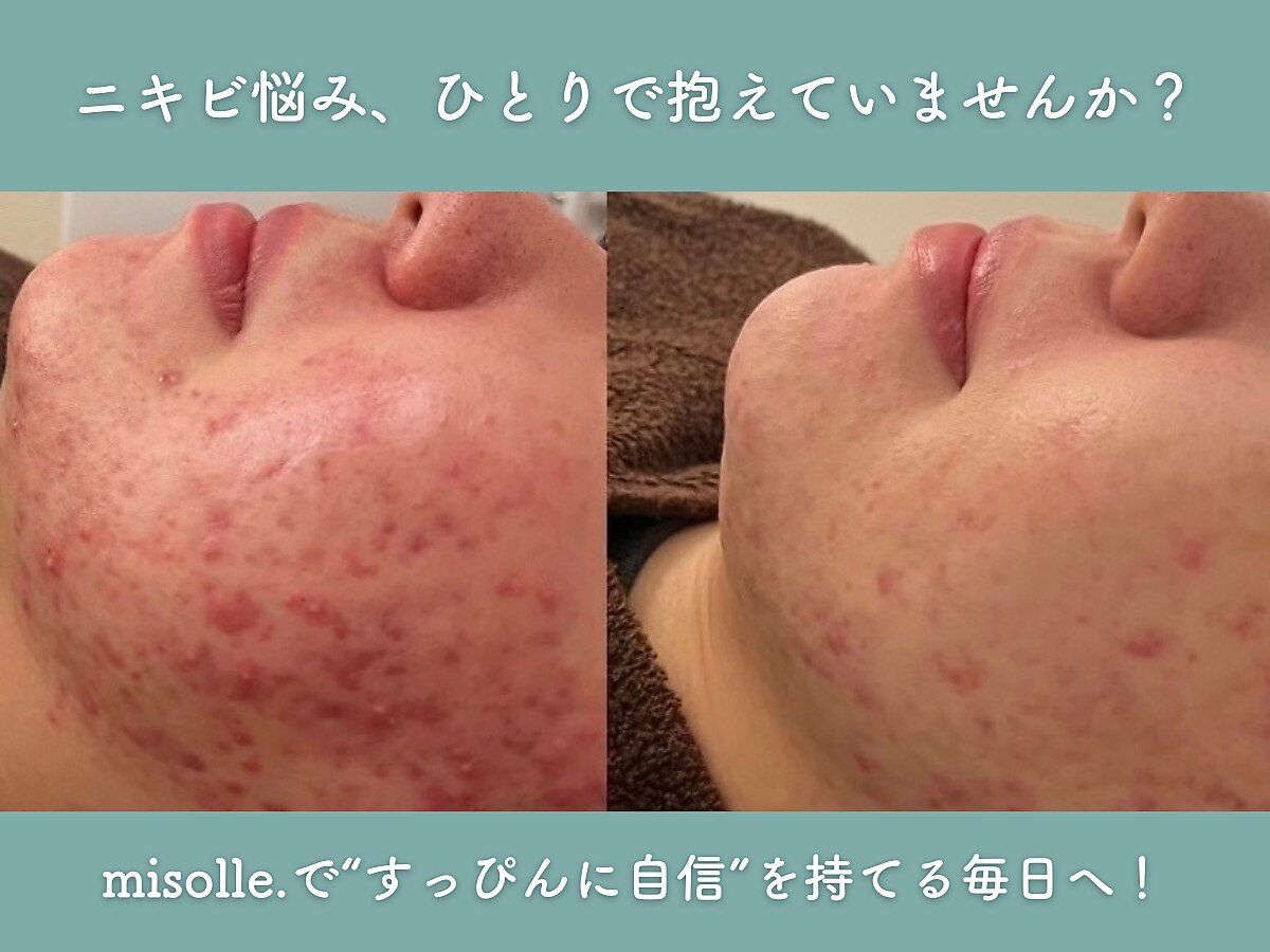 ミソルのオーナーと店内の様子